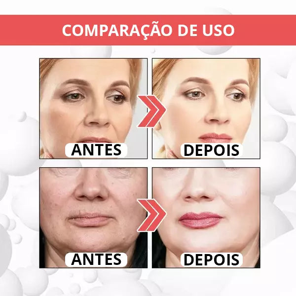 Botox UP - [TRATAMENTO DE MINUTOS] + 1 BRINDE EXCLUSIVO