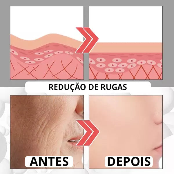Botox UP - [TRATAMENTO DE MINUTOS] + 1 BRINDE EXCLUSIVO